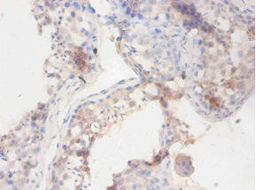 BCHE Antibody (PACO25224)