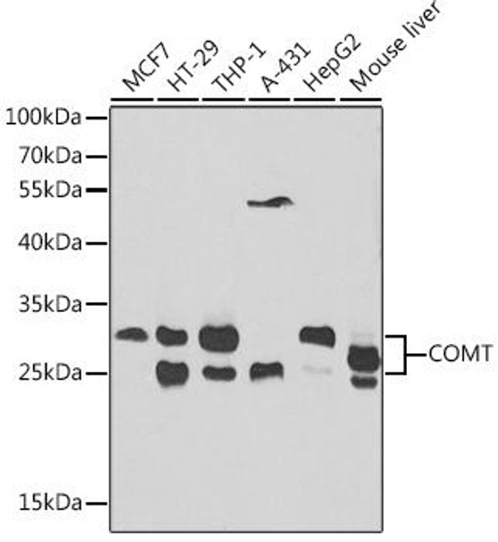 Anti-COMT Antibody (CAB1294)