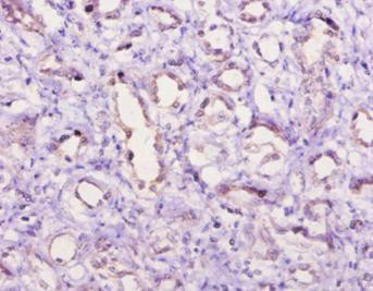 C5 Antibody (PACO25384)