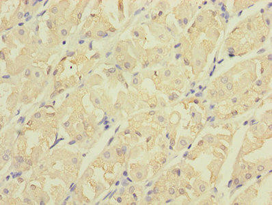 CDC42EP2 Antibody (PACO25664)