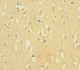 CDK2AP2 Antibody (PACO25676)