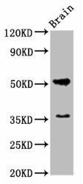 Chrm1 Antibody (PACO25749)