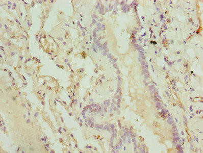 CMC1 Antibody (PACO25825)