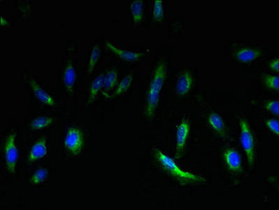 EMP3 Antibody (PACO26469)