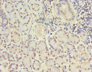 GJB5 Antibody (PACO26993)