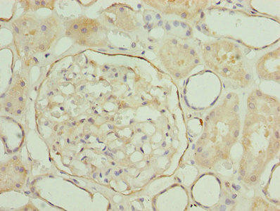 LRRN2 Antibody (PACO28025)