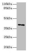 MAGEA10 Antibody (PACO28102)