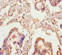 MICAL2 Antibody (PACO28238)