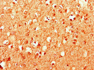 MPDU1 Antibody (PACO28306)