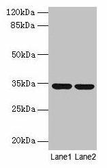 MRPL19 Antibody (PACO28342)