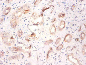 ATP6V1F Antibody (PACO28546)