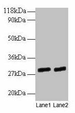 GATD3A Antibody (PACO28994)