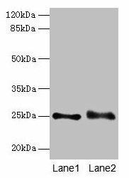 RAB3B Antibody (PACO29332)