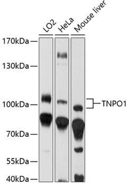 Anti-TNPO1 Antibody (CAB14015)