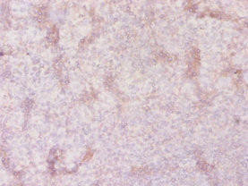 SLC41A2 Antibody (PACO29964)