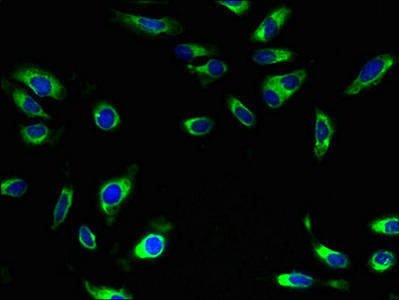 SLC5A10 Antibody (PACO29968)