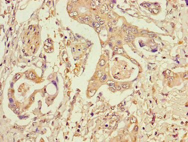 STT3A Antibody (PACO30190)