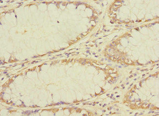 TMEM209 Antibody (PACO30562)