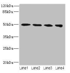 TUBB2A Antibody (PACO30892)