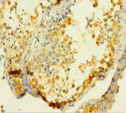 UCK1 Antibody (PACO30972)