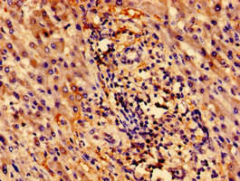 ZNF155 Antibody (PACO31160)