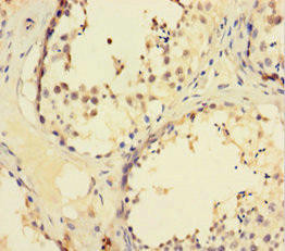 ZNF165 Antibody (PACO31164)