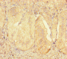 ZNF175 Antibody (PACO31172)