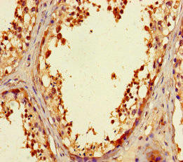 ZNF230 Antibody (PACO31224)