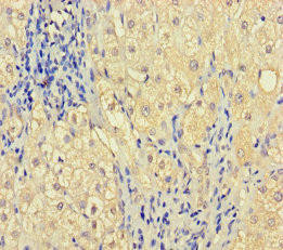 ZNF404 Antibody (PACO31296)