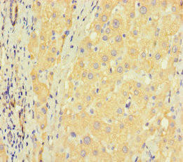 ZNF583 Antibody (PACO31396)