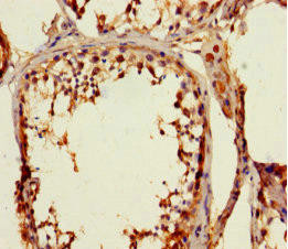 ZNF77 Antibody (PACO31492)