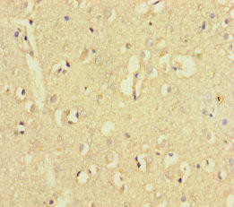 ZNF800 Antibody (PACO31508)