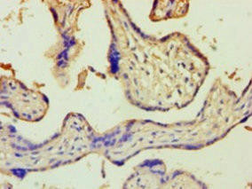 ZRANB2 Antibody (PACO31528)