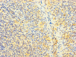 SNX22 Antibody (PACO31800)