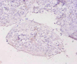 MT1E Antibody (PACO33800)