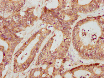 Mmp3 Antibody (PACO33840)