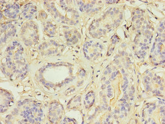 MAP3K7CL Antibody (PACO34582)