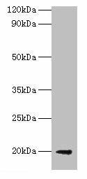 luxS Antibody (PACO35202)