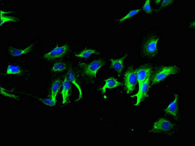 TMEM267 Antibody (PACO35250)