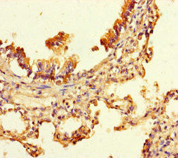 UBXN2B Antibody (PACO35402)