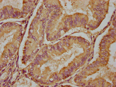 PDE6H Antibody (PACO35442)