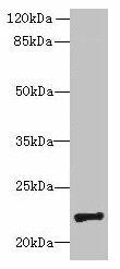 PIGH Antibody (PACO35450)