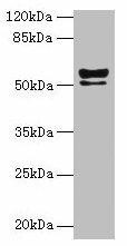 KRT72 Antibody (PACO35590)