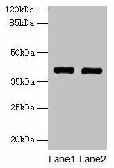 MAB21L1 Antibody (PACO35754)