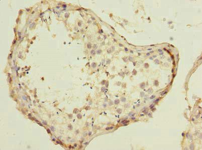ESRG Antibody (PACO35818)