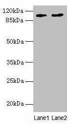 CCDC57 Antibody (PACO35882)