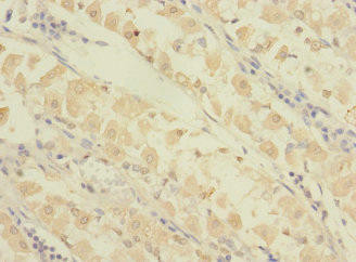 GRAMD1B Antibody (PACO35950)