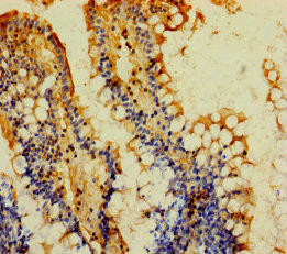 MOGAT2 Antibody (PACO35962)