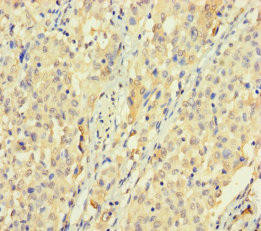 SPATS1 Antibody (PACO36046)