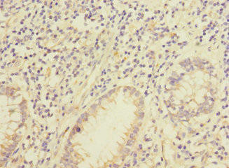 IQCC Antibody (PACO36066)